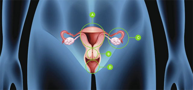 Hystérectomie - Dr Bénédicte Henry | Rajeunissement Vaginal ...